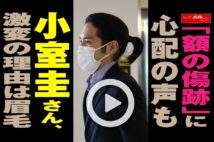 【動画】「額の傷跡」に心配の声も　小室圭さん、激変の理由は眉毛