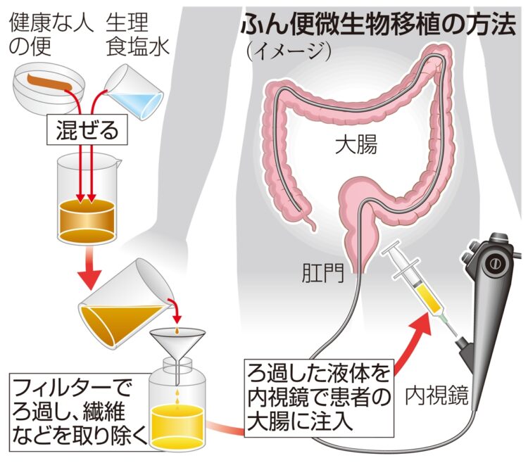 （写真／共同通信社）