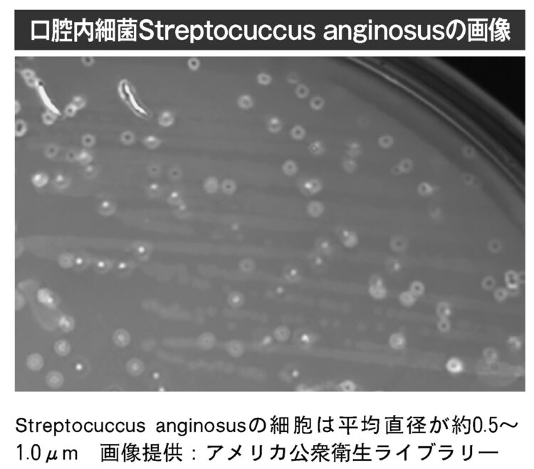 口腔内細菌Streptocuccus anginosusの画像