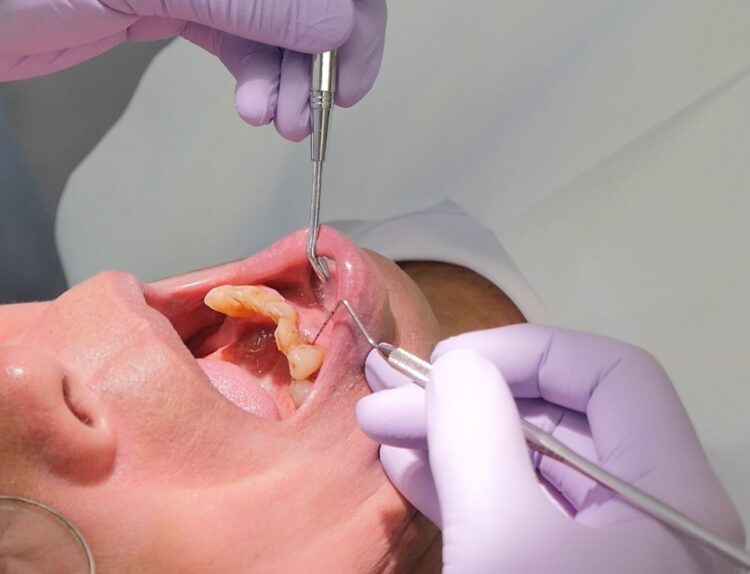 歯周病対策には、良いかかりつけ歯科医の協力が欠かせない（イメージ）