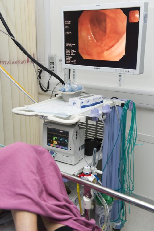 大腸内視鏡検査（写真／AFLO）