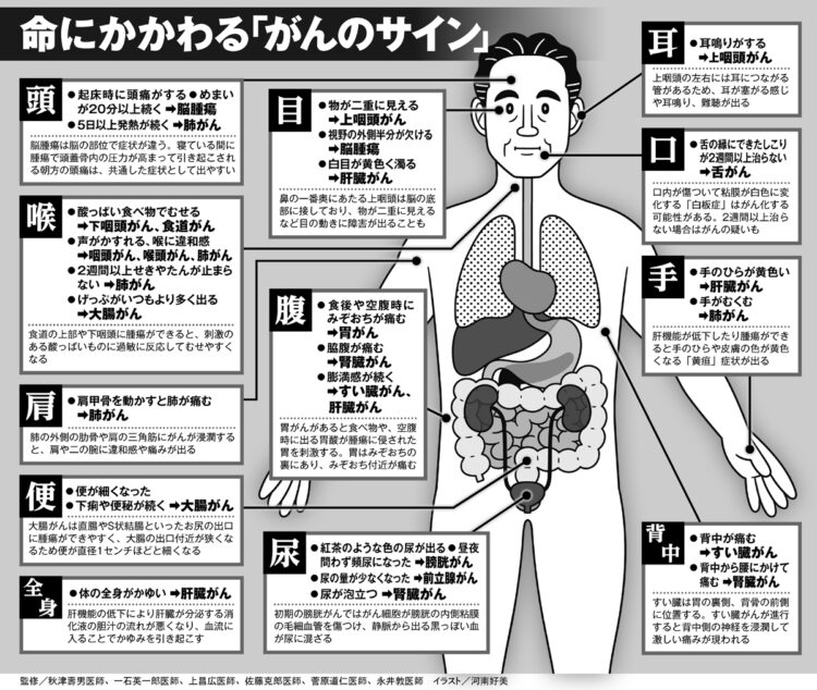 命にかかわる「がんのサイン」