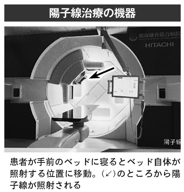 陽子線治療の機器