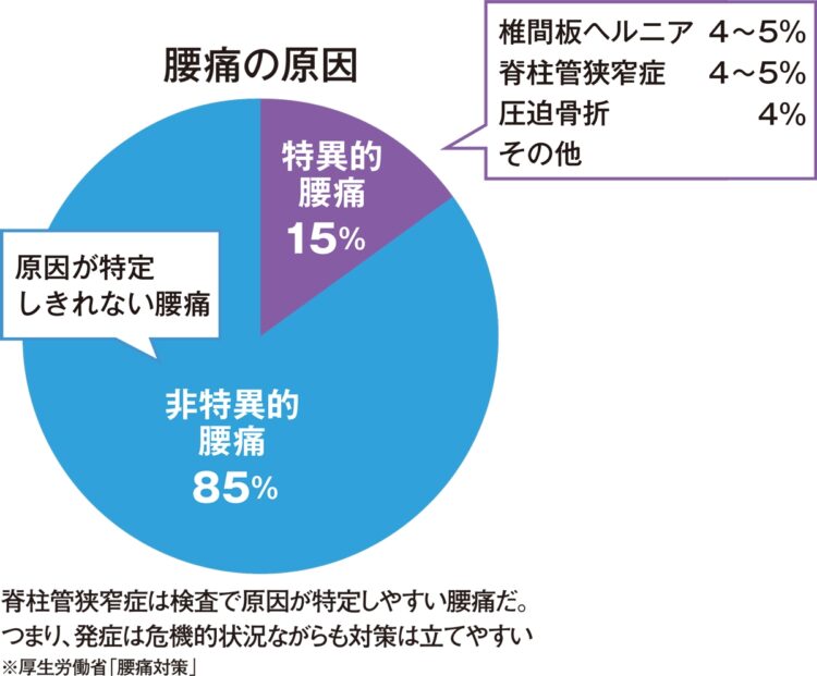 脊柱管狭窄症は検査で原因が特定しやすい腰痛だ。つまり、発症は危機的状況ながらも対策は立てやすい