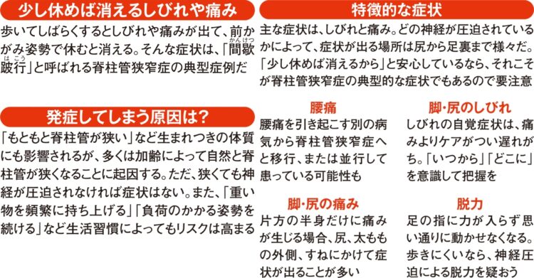 脊柱管狭窄症の特徴的な症状