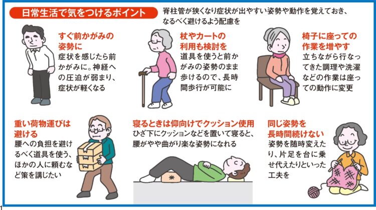 「脊柱管狭窄症」日常生活で気をつけるポイント