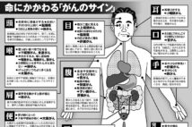 命にかかわる「がんのサイン」