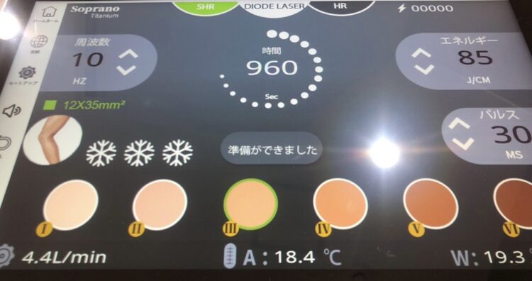 偽物の機械にはメーカーのロゴが入っていないケースや、画面には日本語の表記があることが多いという（写真／渡辺さん提供）