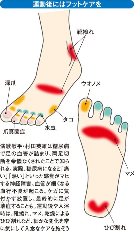 運動後にはフットケアを