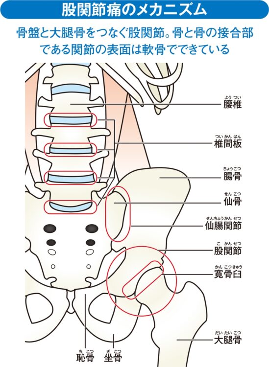 股関節痛のメカニズム