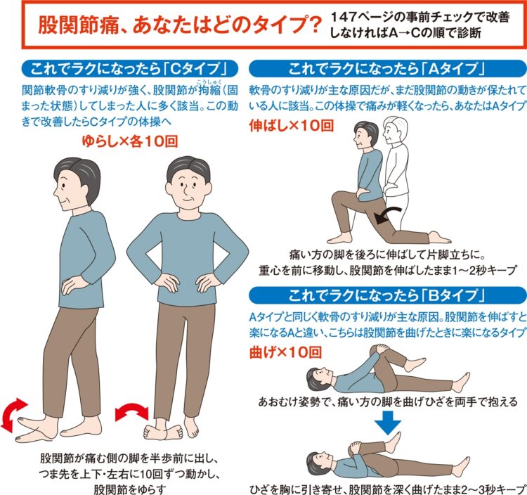 股関節痛、セルフチェック（A～Cタイプ）