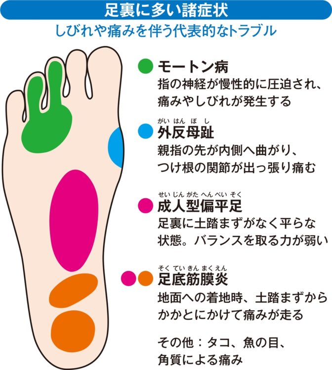 足裏の痛み しびれを消してラクに歩く 足裏寿命を延ばす筋トレ マッサージ Newsポストセブン