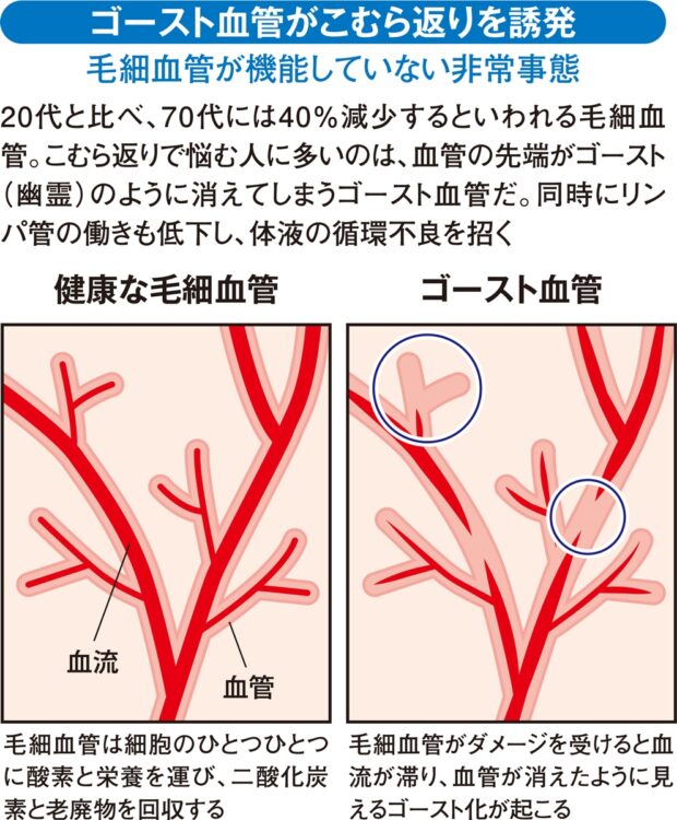 ゴースト血管がこむら返りを誘発