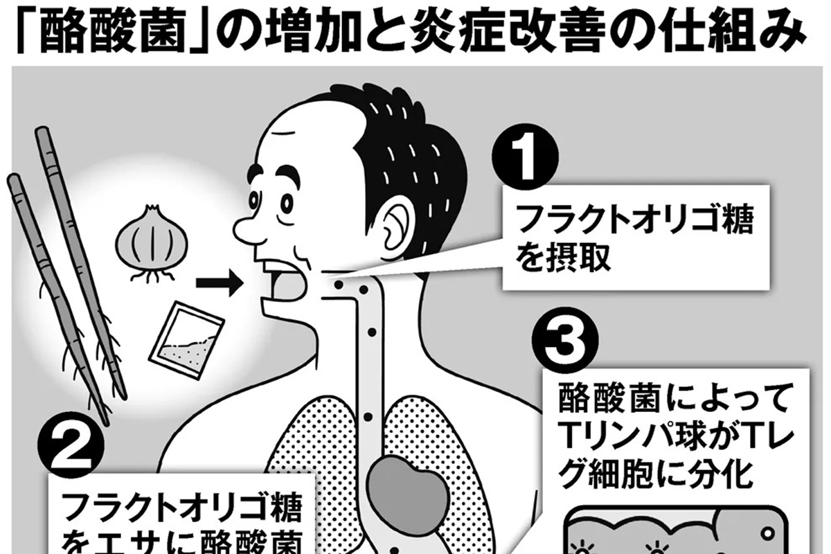 東大名誉教授が提唱する新しい花粉症対策 フラクトオリゴ糖 の摂取がカギ Newsポストセブン