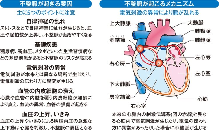 不整脈が起こるメカニズムと不整脈が起きる要因