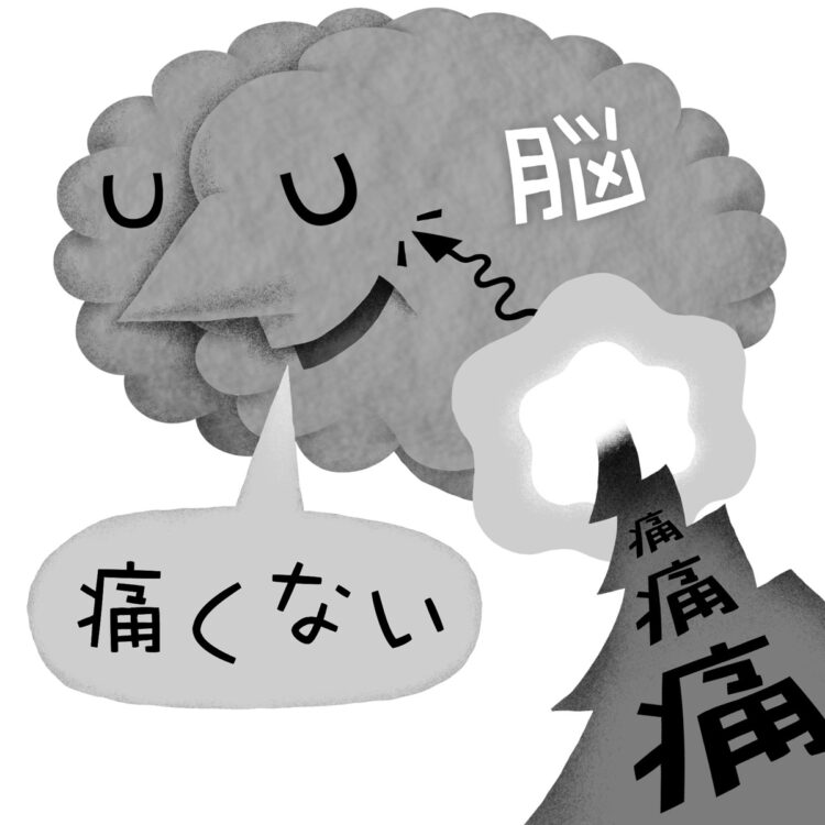 脊髄刺激療法（SCS）とはどんな治療法か（イラスト／いかわ やすとし）