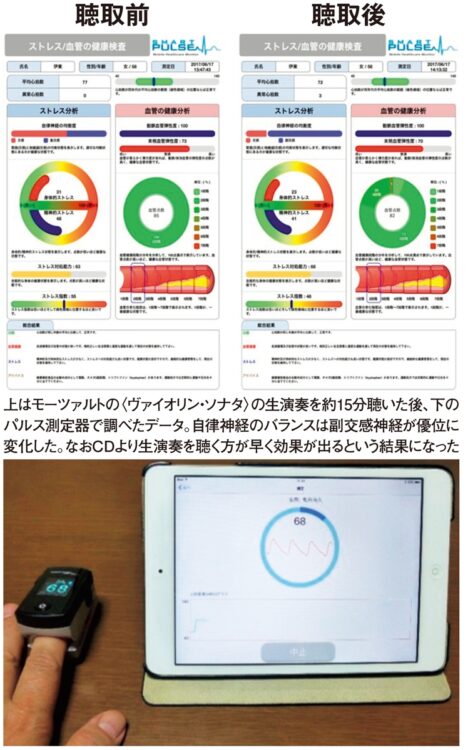 モーツァルトの音楽を聴いた際の影響を検証