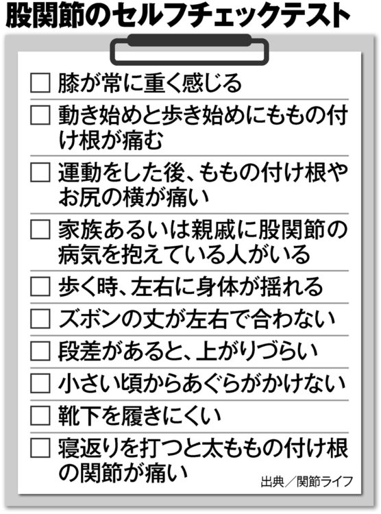 股関節のセルフチェックリスト