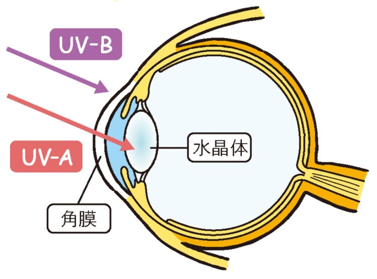 目の日焼けで老眼や白内障に