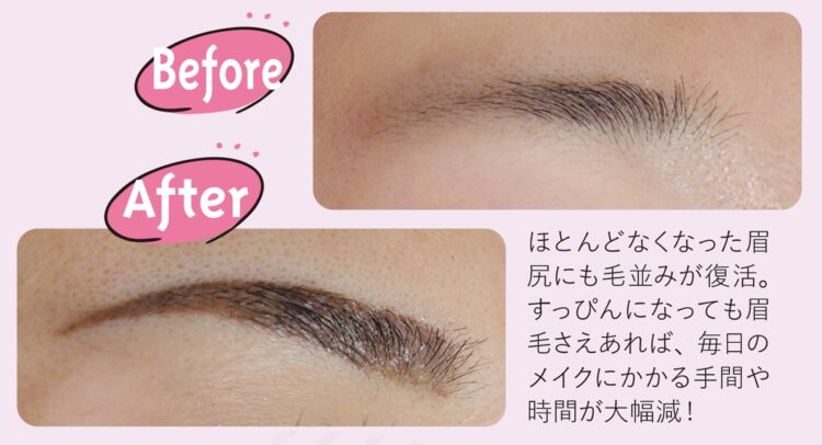 毛がないところも復活