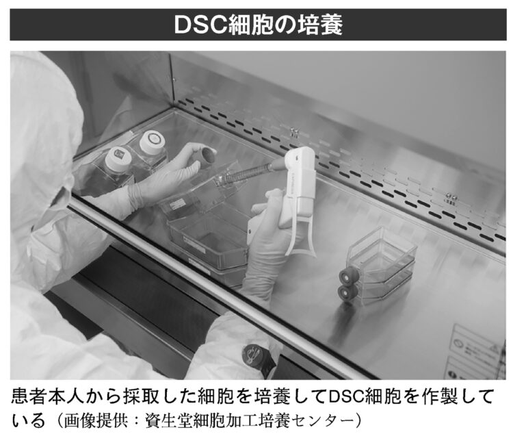 DSC細胞の培養