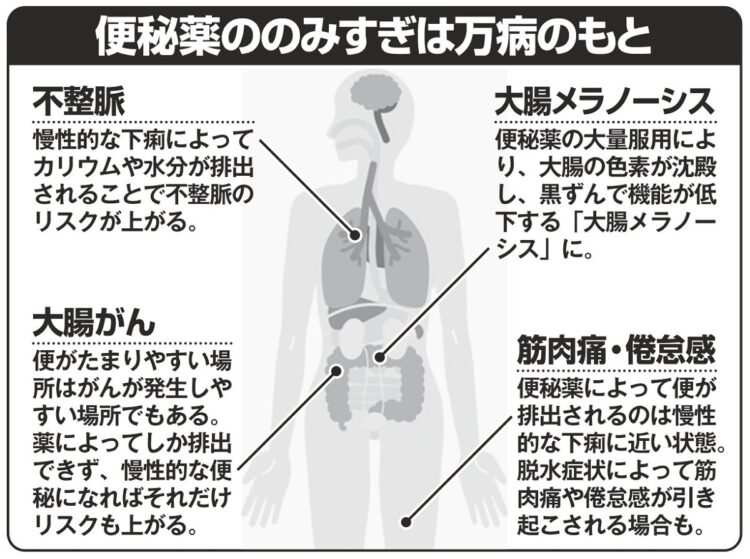便秘薬ののみすぎでは…
