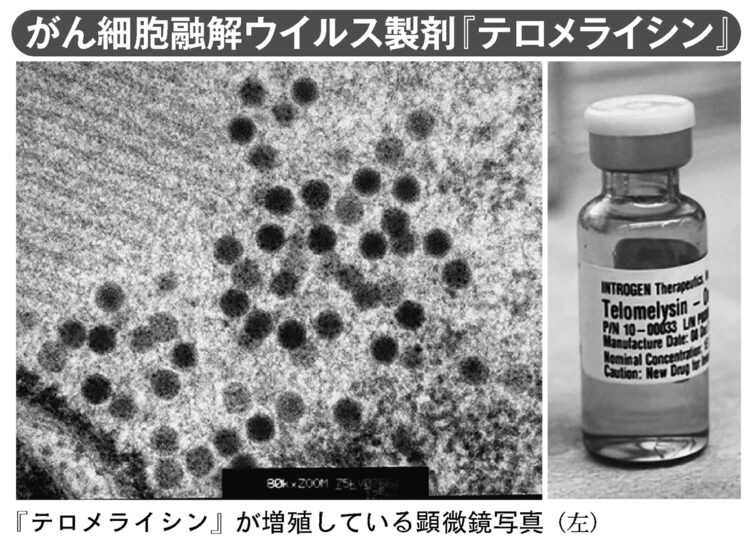 がん細胞融解ウイルス製剤『テロメライシン』