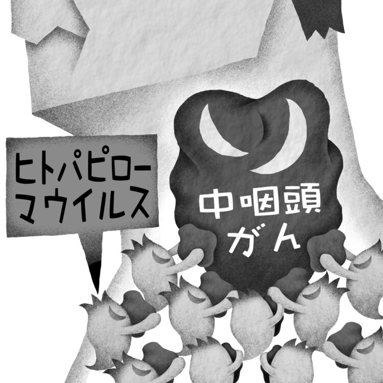 男性の「中咽頭がん」増加の原因は？（イラスト／いかわやすとし）