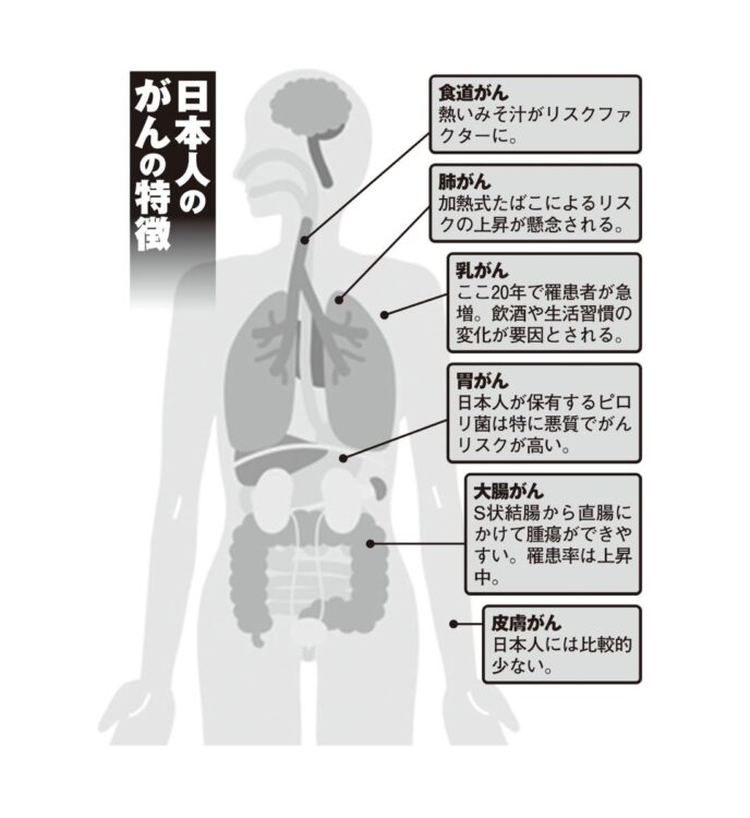 日本人のがんの特徴