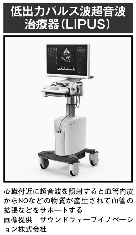 心臓付近に超音波を照射すると血管内皮からNOなどの物質が産生されて血管の拡張などをサポートする（画像提供：サウンドウェーブイノベーション株式会社）