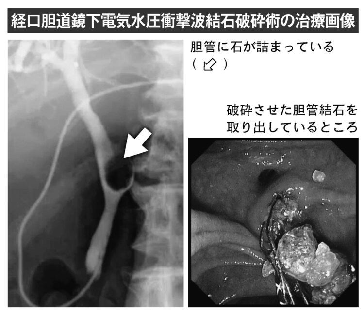 治療の様子