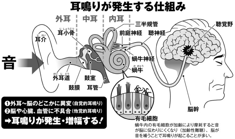 耳鳴りが発生する仕組み