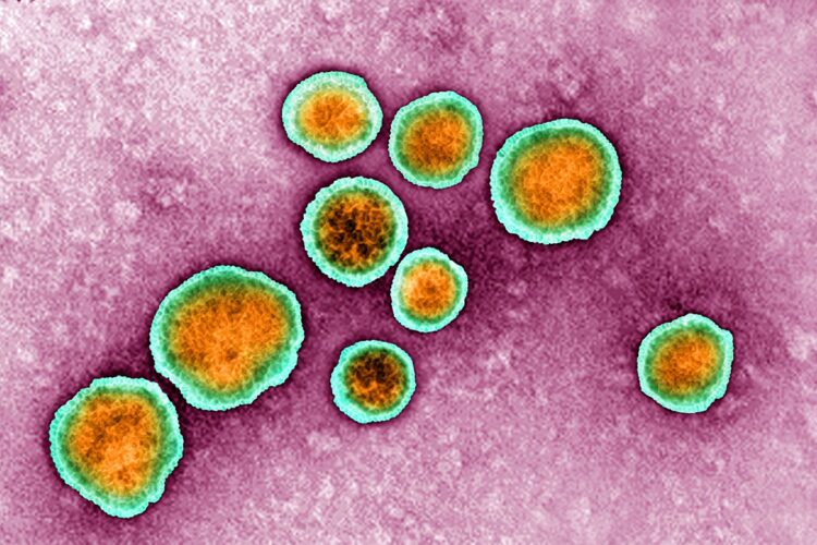 RSウイルス（時事通信フォト）