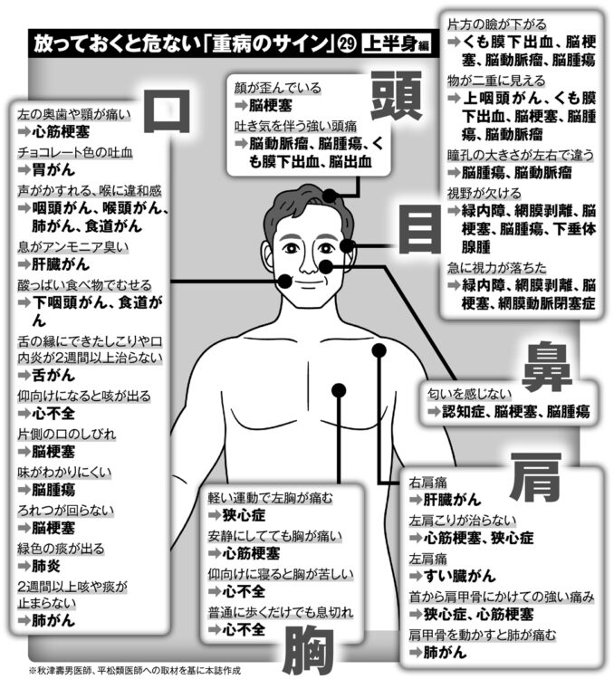 放っておくと危ない「重病のサイン」29（上半身編）