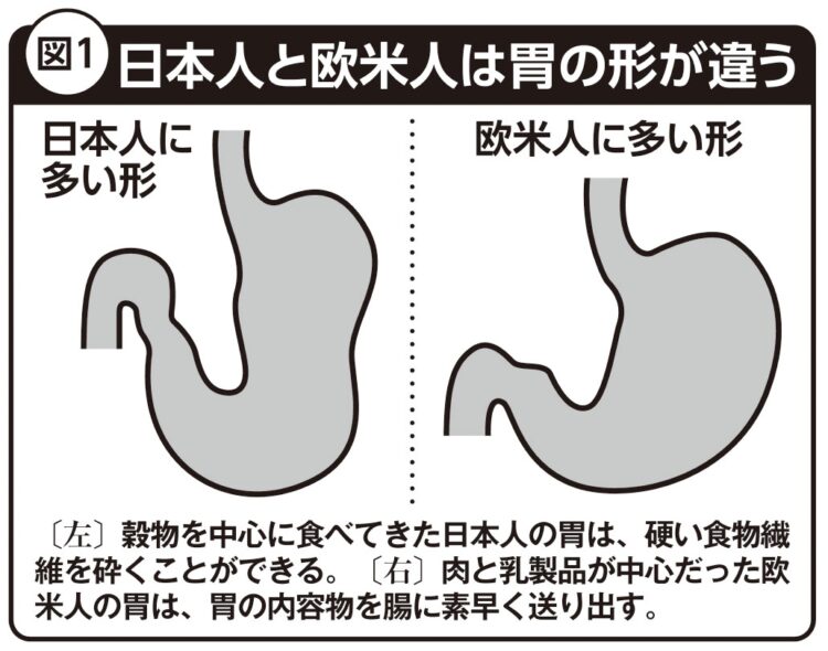 日本人と欧米人は胃の形が違う
