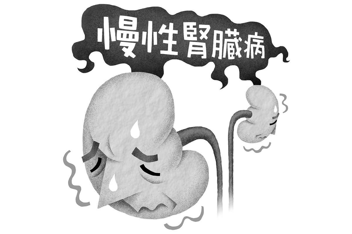 Amazon.com: CKD診療現場の疑問に答えるQ&A: 9784498124769