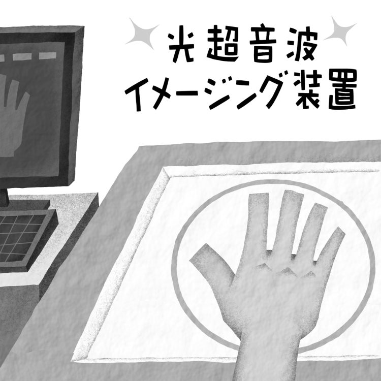 「光超音波イメージング装置」の仕組みとは（イラスト／いかわやすとし）