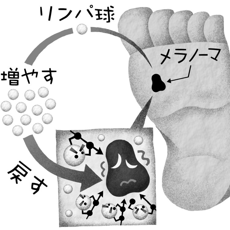 1回の治療ですむTIL療法に注目が集まる（イラスト／いかわやすとし）