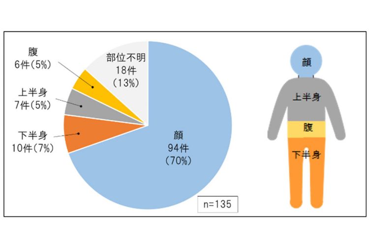 ハイフによる部位別の事故件数。出典／消費者庁 消費者安全調査委員会