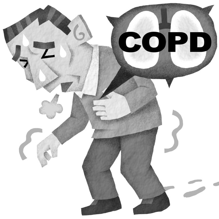 国内に700万人以上の患者がいると推計されているCOPD（慢性閉塞性肺疾患）。イラスト／いかわやすとし