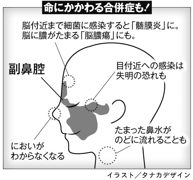命にかかわる合併症も
