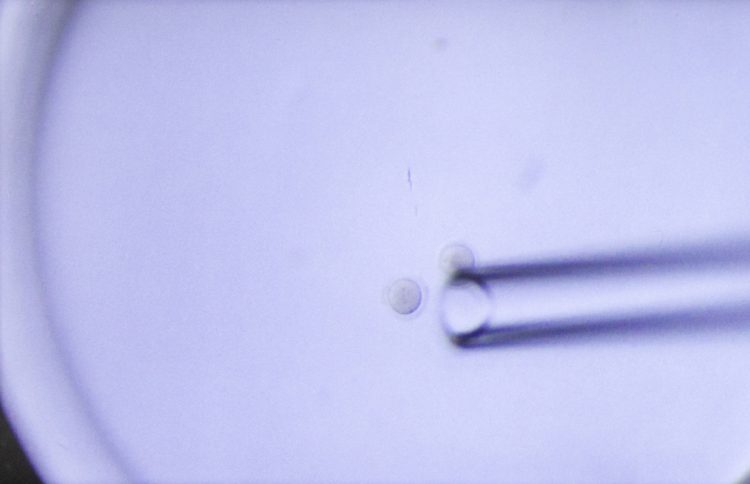 顕微鏡下で卵胞液から卵子（正確には卵子卵丘細胞複合体）を見つけ出し、ピペットで吸引していく