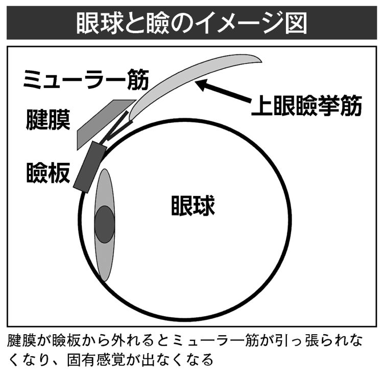 眼球と瞼のイメージ図