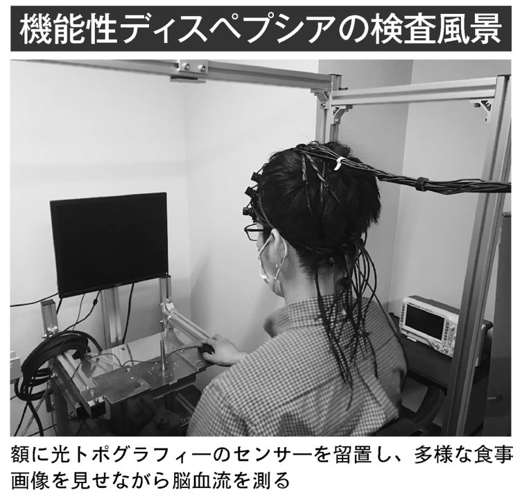 機能性ディスペプシアの検査風景