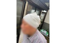 クマに襲われた80歳男性が語る「恐怖」
