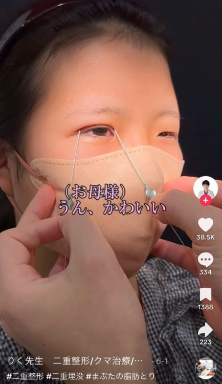 手術前のカウンセリングの様子