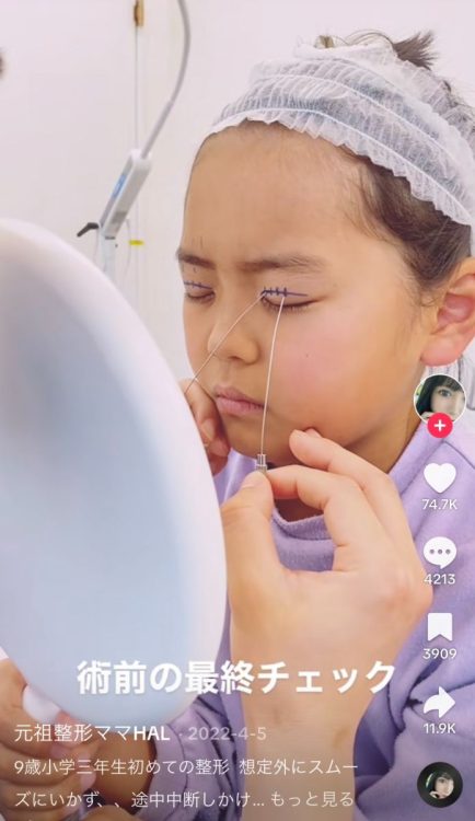 鏡で確認しながらカウンセリング