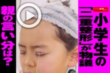 【動画】小学生の「二重整形」が物議　親の言い分は？