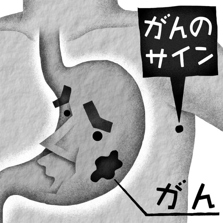 皮膚に出現「デルマドローム」とは？（イラスト／いかわやすとし）