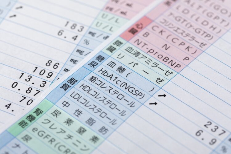 表に表れる数字がすべてではない？（写真／PIXTA）